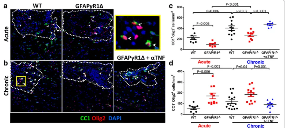 Fig. 3 TNF blockade promotes OPC differentiation during progressive EAE in GFAPγR1Δ mice