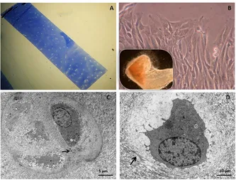 Figure 9. Control cartilage; (A) Toluidine Blue stained cartilage, (B) Cartilage explant cul-(C)-(D) TEM of control cartilage