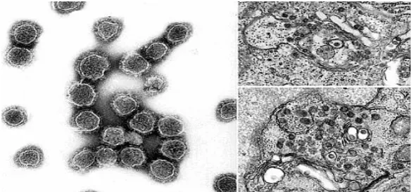 Figure 4: Pathophysiology of La Crosse Virus. 