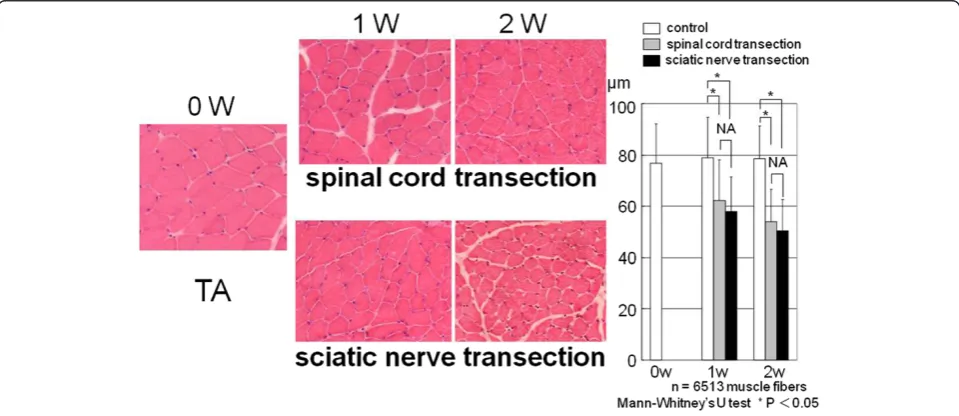 Figure 2 The mean diameter of the soleus muscle fiber in the sciatic nerve transection group was significantly less than that in thespinal cord tarnsection group