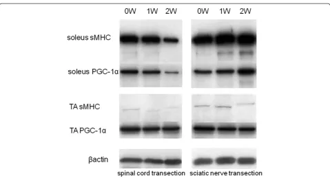 Figure 6 Western blot pattern showed the expression of sMHC (slow myosin heavy chain) in the soleus muscle decreased with timetransection group and in the sciatic nerve transection group.after spinal cord transection, whereas increased with time after scia