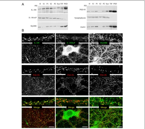 Figure 1 Characterisation of IL-1RI, IL-1RAcP and MyD88 subcellular distributions in rat hippocampi and primary hippocampalmagnification images are shown at the top of each panel