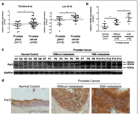 Fig. 1 Par3 expression is upregulated in metastatic PCa tissues.without metastasis and in that from normal persons