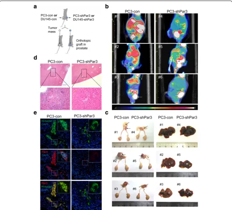 Fig. 3 Knockdown of Par3 inhibits PCa metastasis in vivo. a Strategy for evaluating the effect of Par3 knockdown on metastasis in vivo