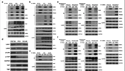 Fig. 5 Elevated expression of Par3 dissociates KIBRA/Merlin/FRMD6 complex by increasing its interaction with KIBRA.and cytoplasmic Par3 with KIBRA and restores the interaction of KIBRA with Merlin and FRMD6.Par3 with KIBRA is increased in both PC3 and DU14