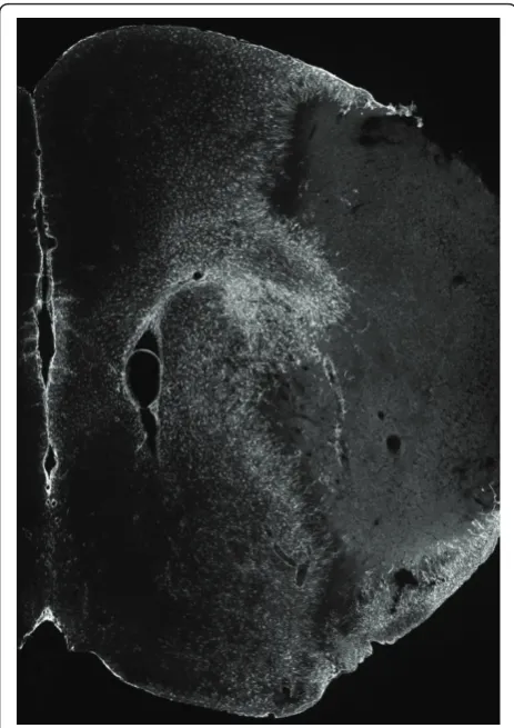 Figure 8 Cerebral GFAP immunoreactivity at day 7 post-tMCAo, in mice. Composite image representing the obtained GFAPimmunoreactivity (Cy3, gray-scale) within the right brain hemisphere7 days after a 45 min occlusion of the right middle cerebral artery,in C57BL/6 mice (epifluorescence micrographs).