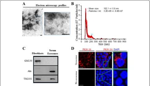 Fig. 2 Cancer patient sera-isolated exosomes are efficiently internalized by target cells.microscopy on cancer patient sera exosome preparations