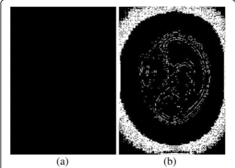 Fig. 8 The edge detection image of original image and the preprocessed image. (a) is the prewitt operator detection image of the originalimage, (b) (c) is the image detected by the prewitt operator and sobel operator, respectively