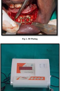 Fig 1. Titanium plating 