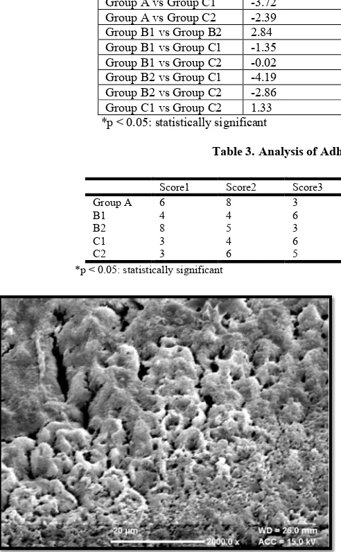 Figure 5. Type 2 etching patterns seen after treating the enamel surface with deproteinizing agent before enamel etching with 20% lactic acid 