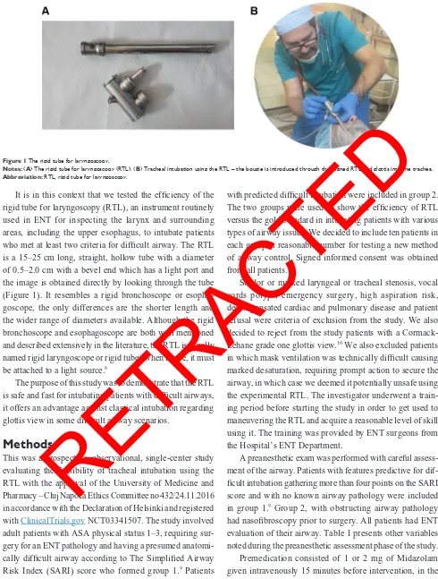 Figure 1 The rigid tube for laryngoscopy.RETRACTED