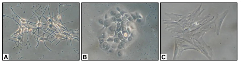 Figure 4 Surgical technique: laser ablation, lipotransplantation and epidermal cell suspension graft