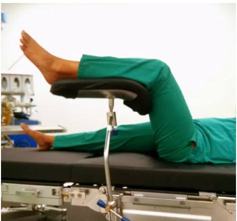 Figure 3 Well leg positioning on a fracture table: using a pillow sling.Note: Photographs used with permission from Am J Orthop