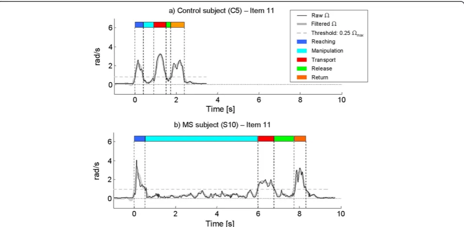 Table 6 Comparison between healthy controls and MS subjects with subtle arm impairment – ARAT tasksub-movements