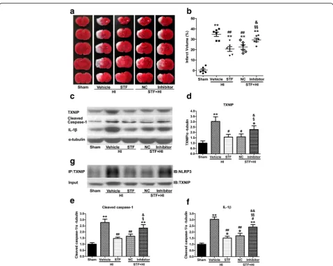 Fig. 7 miR-17-5p inhibitor increased infarction, upregulated TXNIP expression, NLRP3 inflammasome activation and IL-1assay bands for interaction between NLRP3 and TXNIP