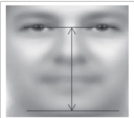 Fig. 8 LBP operator