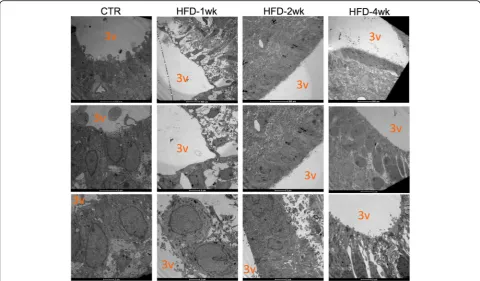 Fig. 3 Ultrastructural analysis of the cells in the interface between the median eminence, arcuate nucleus, and third ventricle