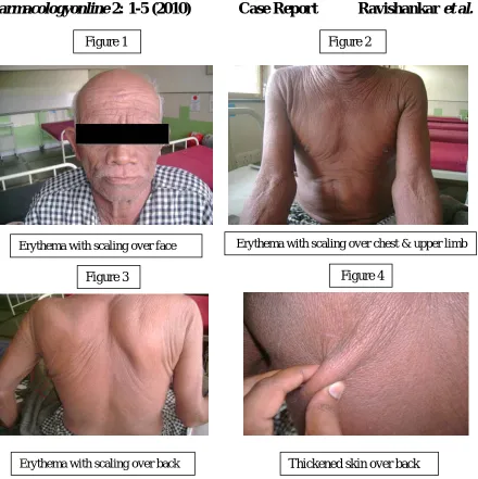   Figure 1 Figure 2 