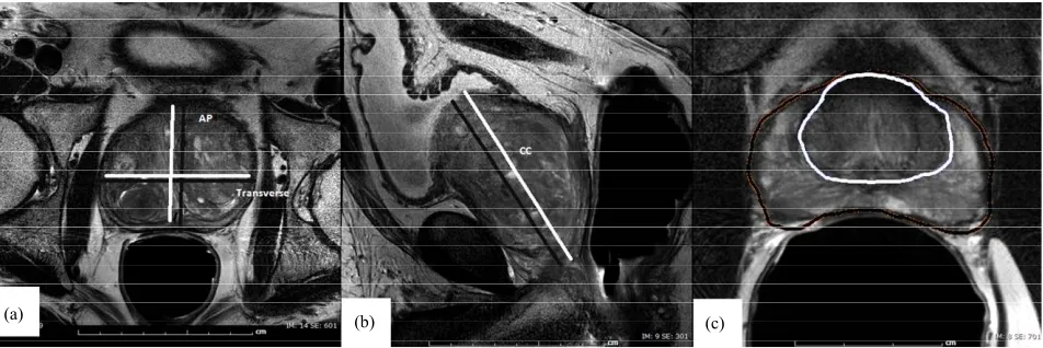 Figure 1. Prostate volume calculation. Image (a) and (b) show the measurements for the prolate ellipse method