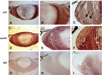 Fig. 9. Immunocytochemical localization of MdmX, and p53 in the chick E14 lens. (A–C) p53 Staining is localised to the lens epithelium cells and the lens ﬁbres cells in the outer lenscortex