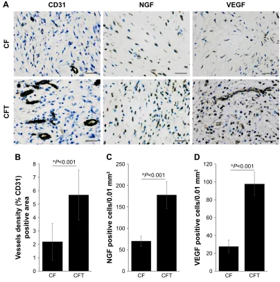 Table 2 The density of ngF+ cells in callus tissues is correlated with serum ngF levels (n=47)