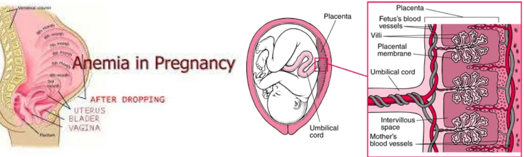 Figure 1. Anemia during pregnancy and fetus positions   