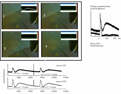 Figure 2. The 4 frames show the computer combined output of a camera and the amplified output of a microelectrode inserted in the cal profile is at the peak