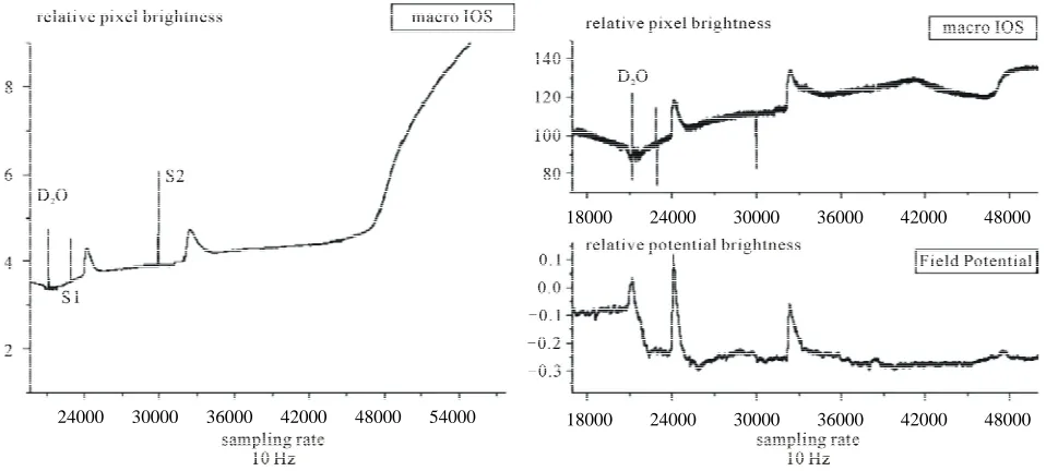 Figure 4. Three simultaneously recorded time series of a deuterium experiment in which the whole retina died within 2 hours of tential and microscopic IOS suggesting that structural tissue changes follow the charge movement within the tissue