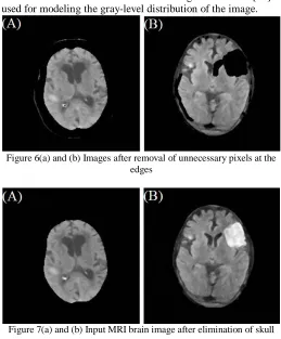 Figure 7(a) and (b) Input MRI brain image after elimination of skull 