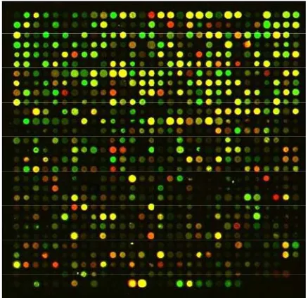 Figure 1. Microarrary image subarray of myeloid leukemia.  