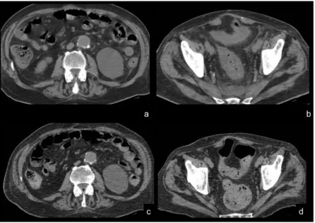 Figure 1. CG, male, 7o yo 