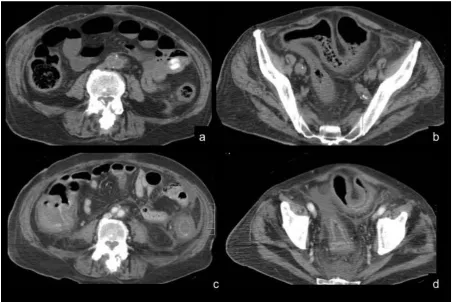 Figure 2. CG, male, 7o yo 