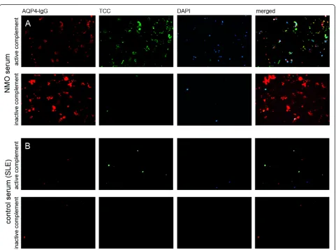 Figure 4 Scanning electron microscopy of serum AQP4-IgG mediated complement activation