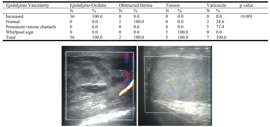 Table 4. Association of diagnosis and epididymis vascularity  