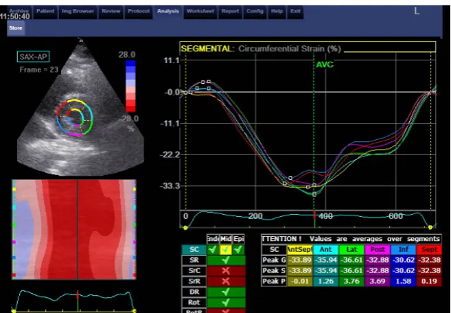 Figure 2. Normal circumferential strain of one of control group. 