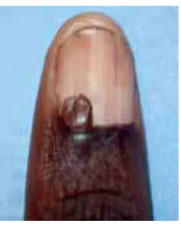 Figure 15. Onychoshizia 