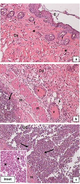 Figure 6. Histology of BALB/c mouse skin lesion infected with S. aureus ATCC 43300 + Z