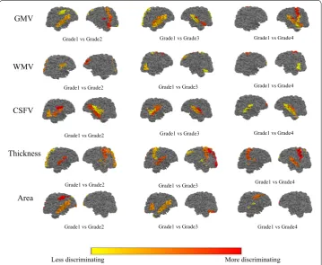 Figure 210) onto the cortical surface. Three connection graphs of the most discriminative brain network features for three groups are shown in Fig. tion between ROIs, while thinner line implies weaker connection