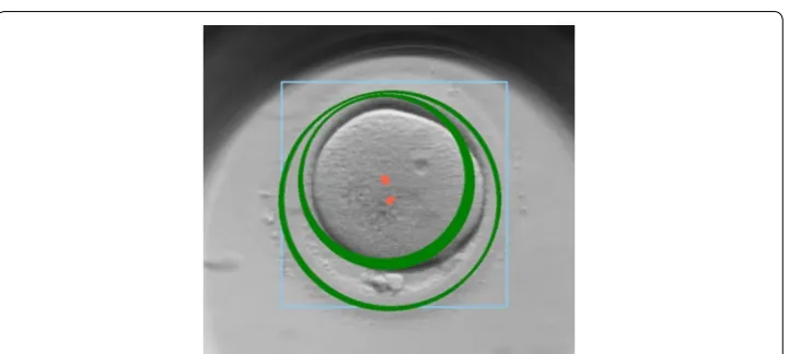 Fig. 2 Illustration of accurate localisation (black rectangle) and unsuccessful localisation (red rectangle) of early‑stage embryo including determination of empty areas; a a detection of wrong area; b a determination of individual cells; c a d a detection of not relevant objects