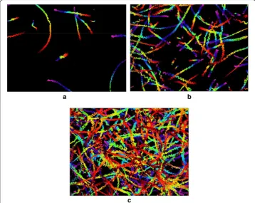 Fig. 4 Typical color‑coded DFT images of three semen samples of different concentrations for 10 s under a 10TMSC × objective lens