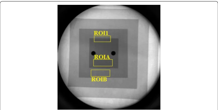 Fig. 14 A frame of the aluminum step phantom fluoroscopic sequence. The manually selected regions of interest are shown in yellow: the ROI1 was chosen for the FWHM estimation and the ROIA and ROIB were chosen for CNR estimation