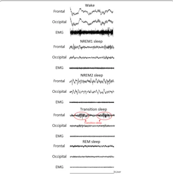 Fig. 1 Typical polygraphic recordings during the different five sleep stages. Frontal, electroencephalogram (EEG) of frontal; Occipital, electroencephalogram (EEG) of occipital; NREM, non‑rapid eye movement; REM, rapid eye movement