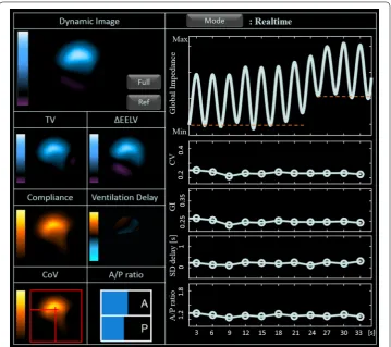 Fig. 9 Real-time screen view of the developed integrated EIT system from the normal lungs