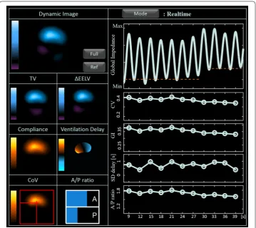 Fig. 8 Real-time screen view of the integrated EIT system from the lungs with acute injury