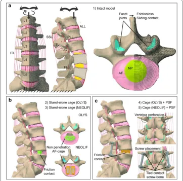 Fig. 1 FE model of the lumbar spine. NEOLIF lumbar spine with a schematic representation of the boundary and loading conditions and the ligaments [antero‑longitudinal ligament (ALL); postero‑longitudinal ligament (PLL); intertransverse ligament (ITL); a (1