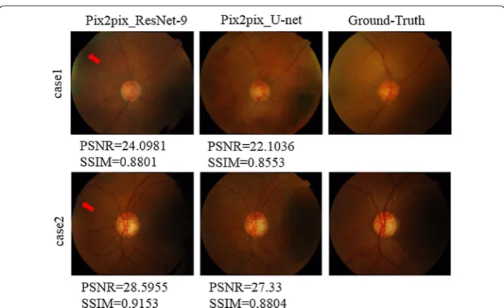 Fig. 6 Special cases of synthetic results with ResNet-9 and U-net generator based on MCML method