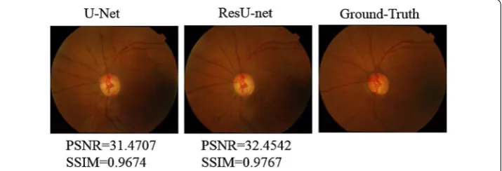 Table 2 Comparison of SSIM and PSNR with different number of residual blocks on U-net generator