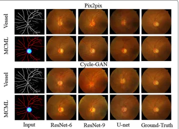 Fig. 4 Exemplar synthetic images generated by our MCML-GAN method and only vessel input method