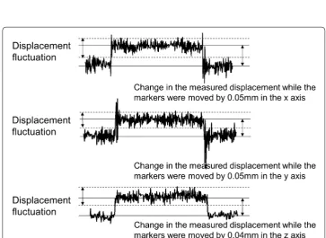 Table 1 Measurement error (mm) of the system