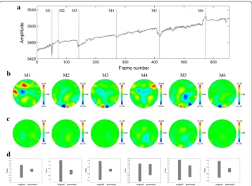 Fig. 9 Comparison of reconstructed images with the original data and processed data. Row A is the mark of head movement occurrence, M1–M6 is the sequence number of head movement